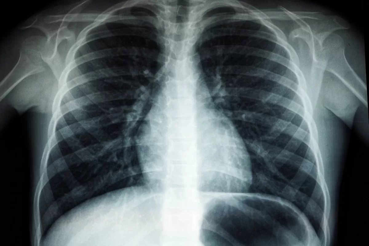 Divisione Pneumologia